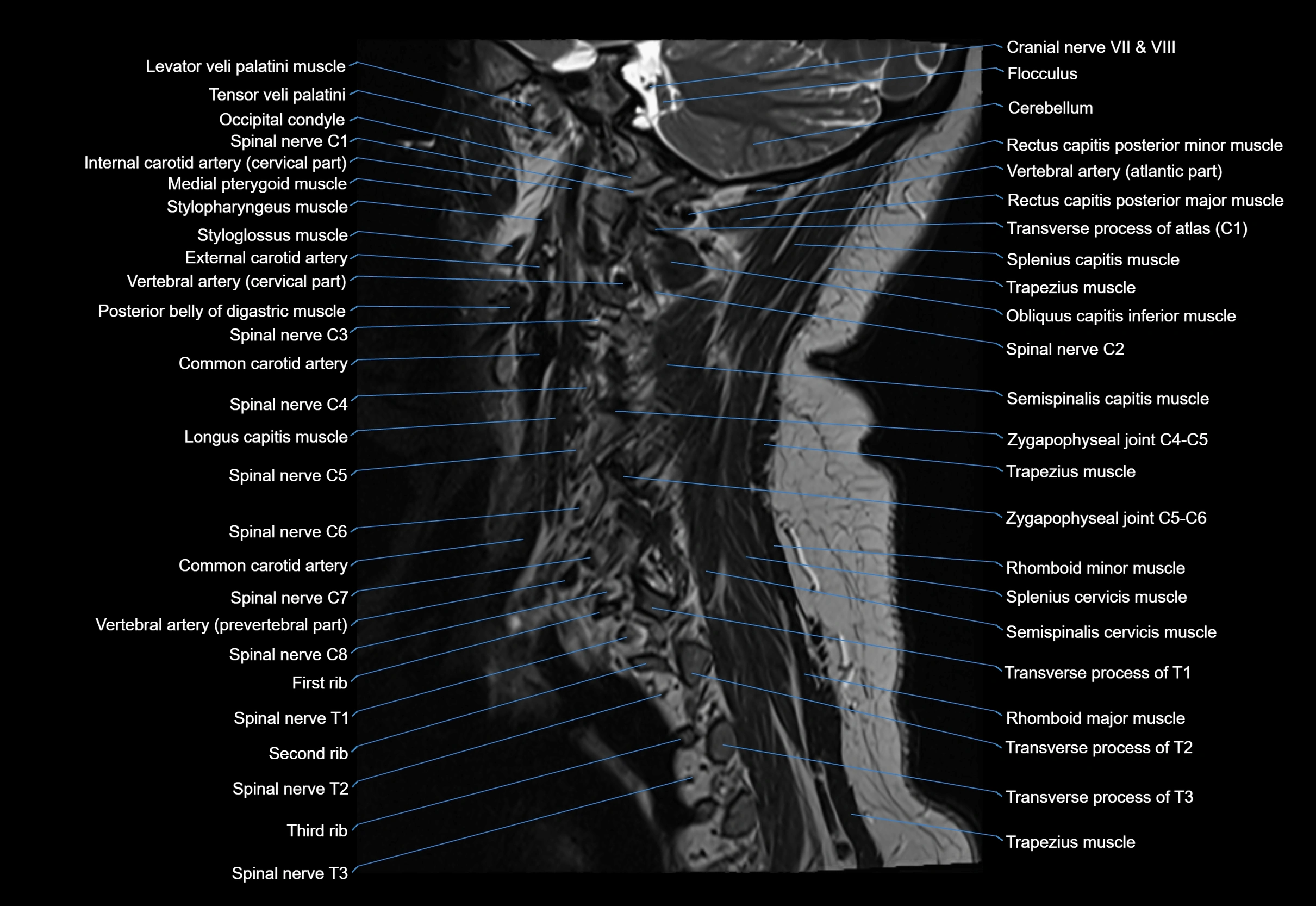 cervical spine cross sectional MRI anatomy 3T MRI  sagittal image-img-00001-00027.webp
